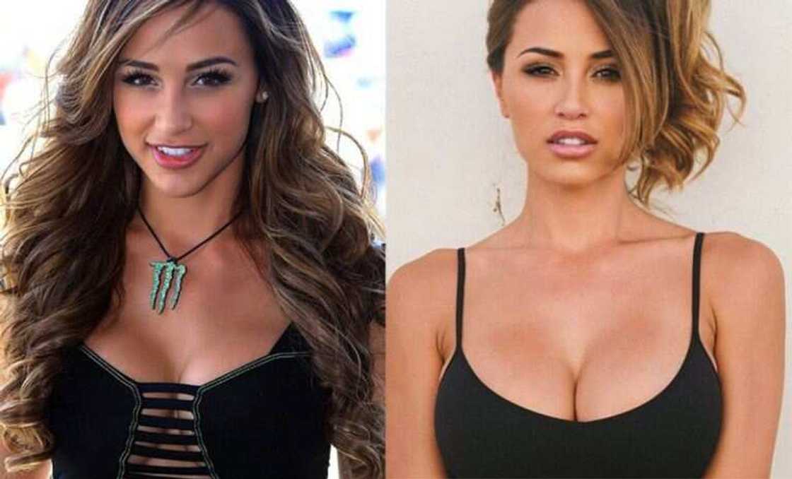 Ana Cheri plastic surgery