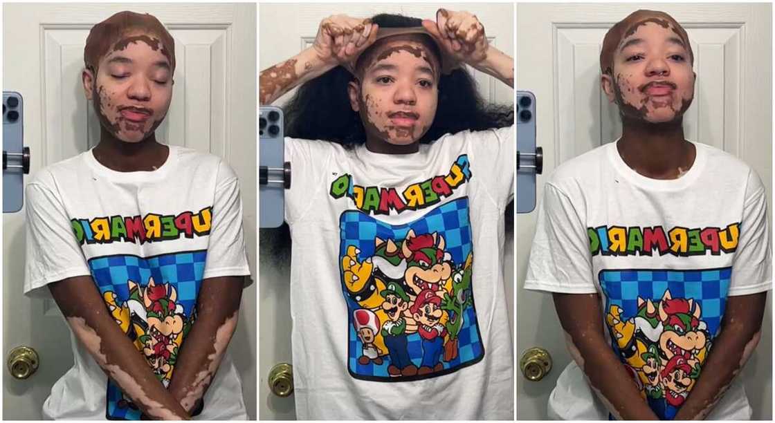 Photos of lady with marks on her face. Photos of lady with marks on her face.