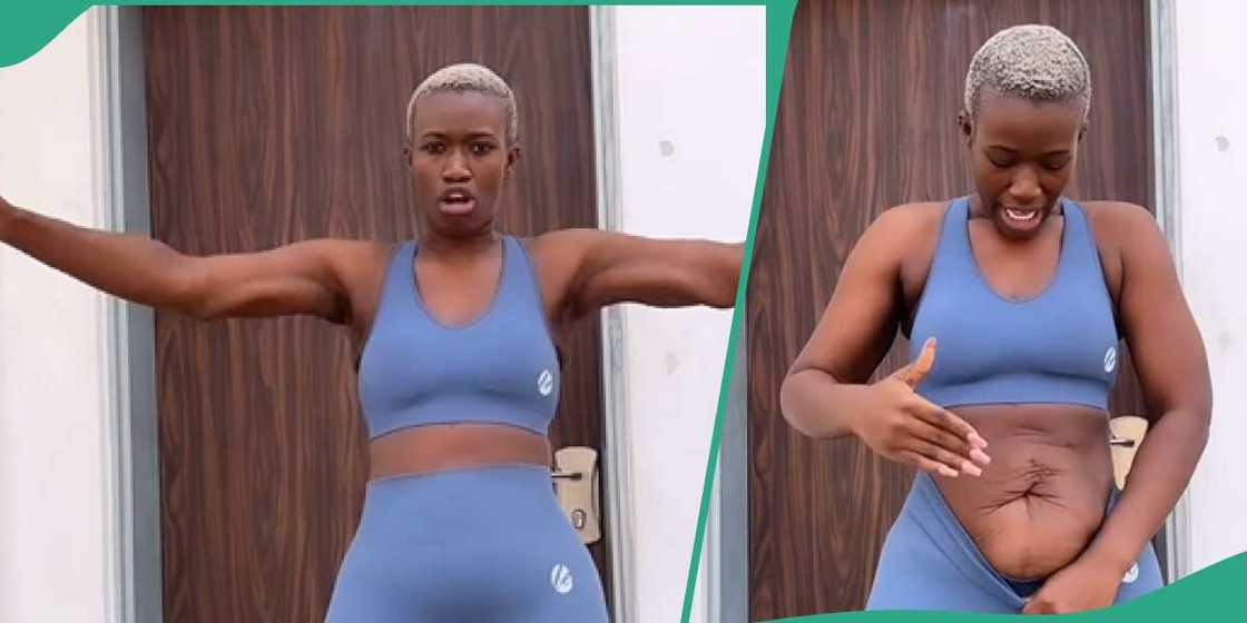 Real Warri Pikin's saggy skin after weightloss surgery. Real Warri Pikin's saggy skin after weightloss surgery.