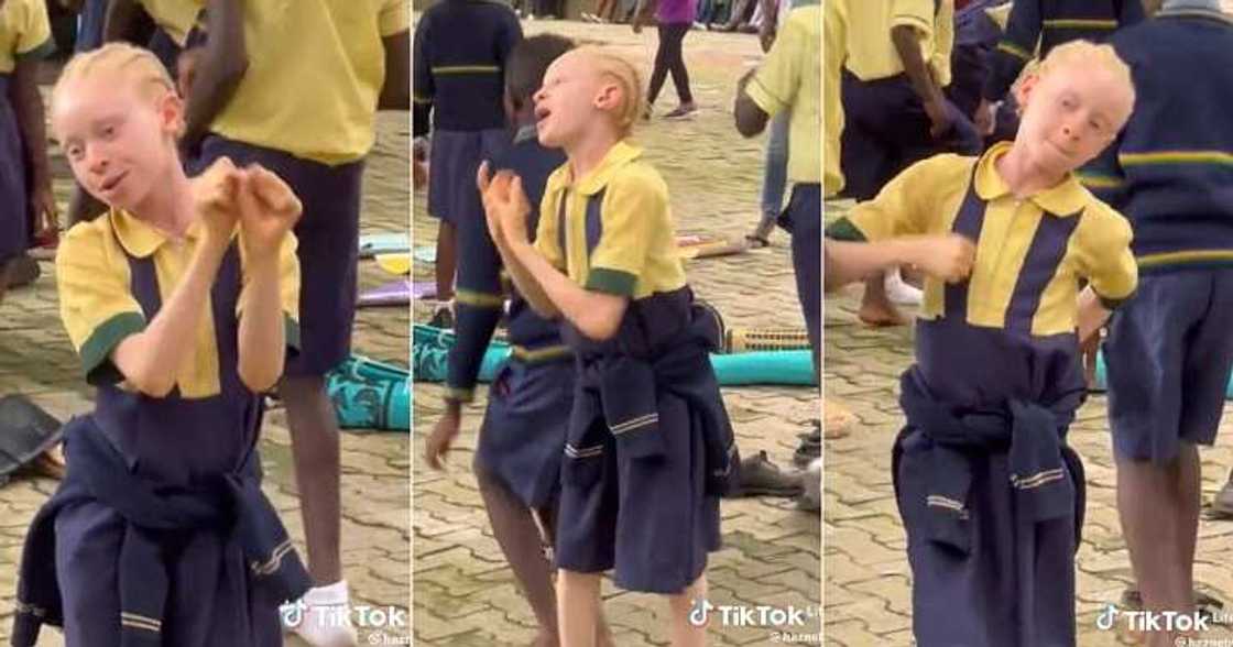 Albino girl dances at school party Albino girl dances at school party