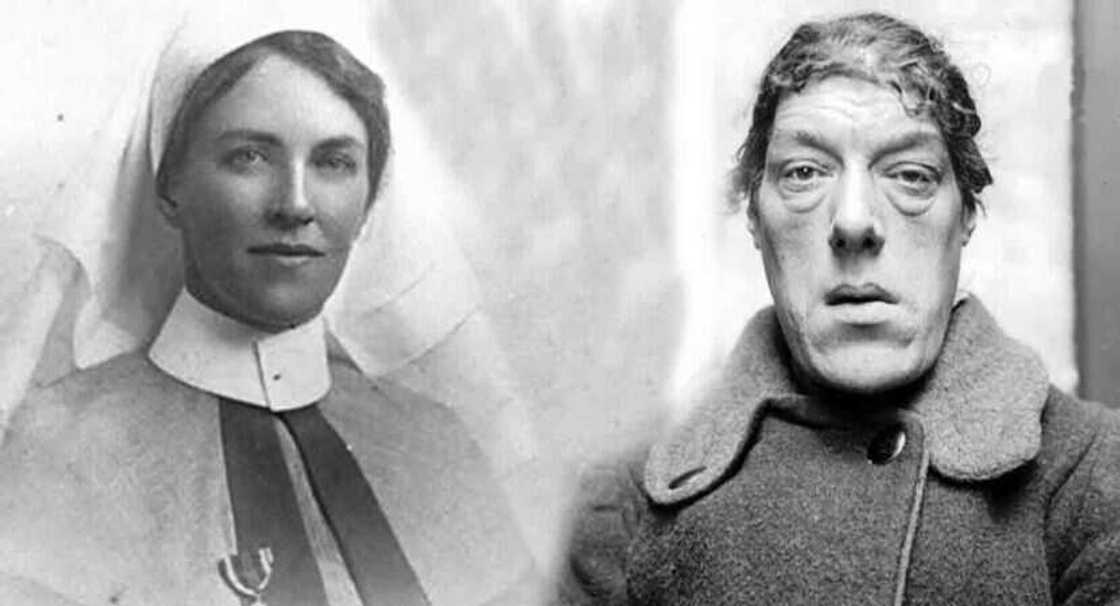 Labarin Mary Ann: Hotunan Matar da ta fi kowa muni a duniya kuma ta ci gasar munana Labarin Mary Ann: Hotunan Matar da ta fi kowa muni a duniya kuma ta ci gasar munana