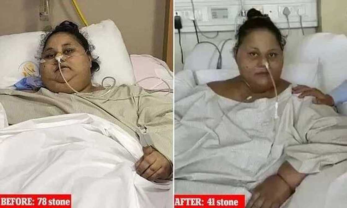 World's heaviest woman sits up for 1st time after losing half her weight World's heaviest woman sits up for 1st time after losing half her weight