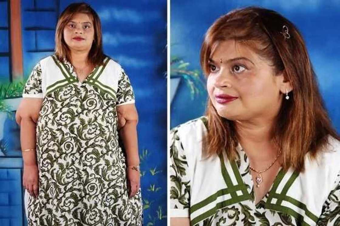 The fattest woman, who weighed 298kg, was bedridden for 8 years, gets new life The fattest woman, who weighed 298kg, was bedridden for 8 years, gets new life