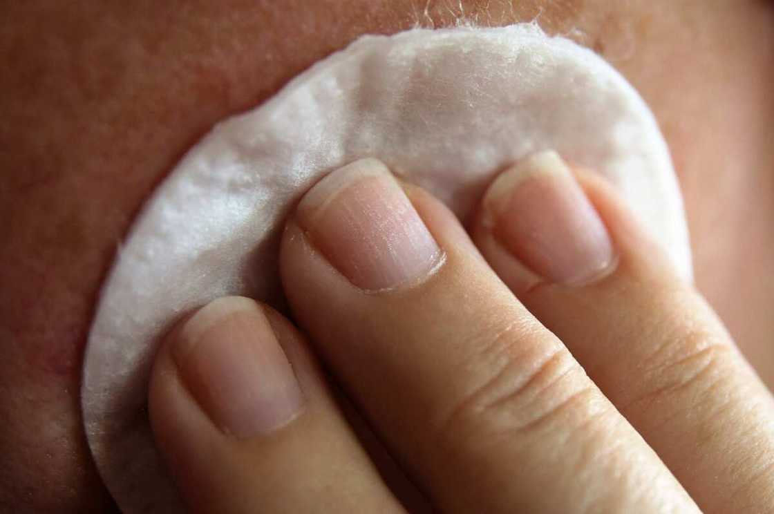 How to remove bandage adhesive from skin