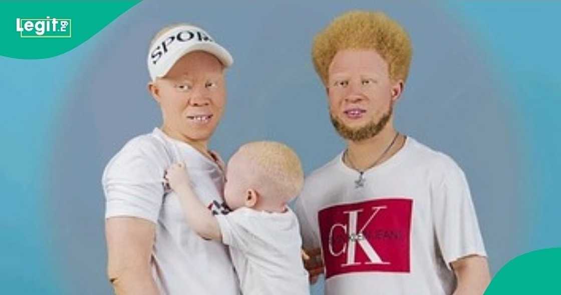 Albino family breaks internet as their video surfaces on TikTok. Albino family breaks internet as their video surfaces on TikTok.
