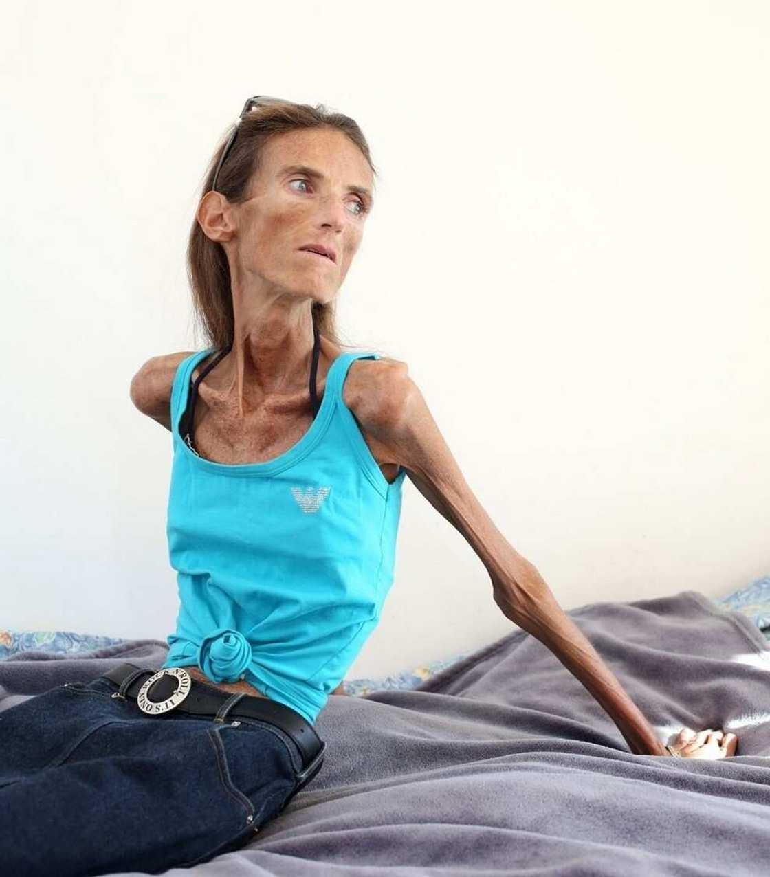 The thinnest woman in the world The thinnest woman in the world
