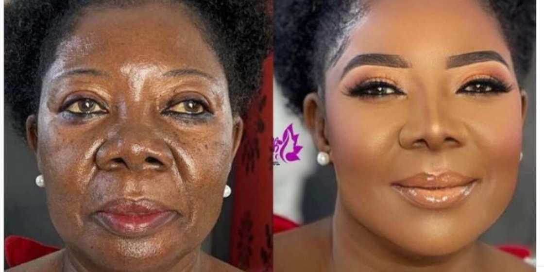 Many people couldn't believe their eyes after seeing the before and after photos of the woman Many people couldn't believe their eyes after seeing the before and after photos of the woman