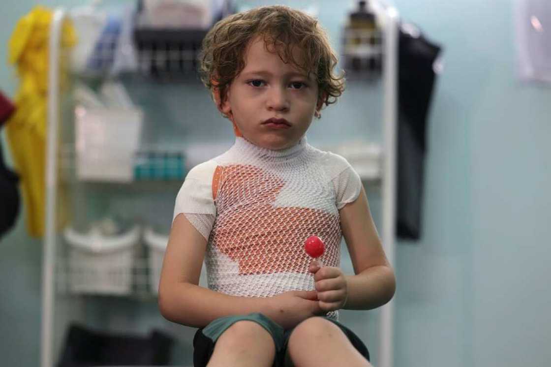 More than a third of the burns patients treated at MSF clinics across Gaza were aged under five More than a third of the burns patients treated at MSF clinics across Gaza were aged under five