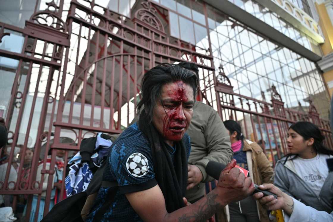 Dozens of people in Bolivia were injured in clashes between followers of ex-president Evo Morales and incumbent Luis Arce Dozens of people in Bolivia were injured in clashes between followers of ex-president Evo Morales and incumbent Luis Arce