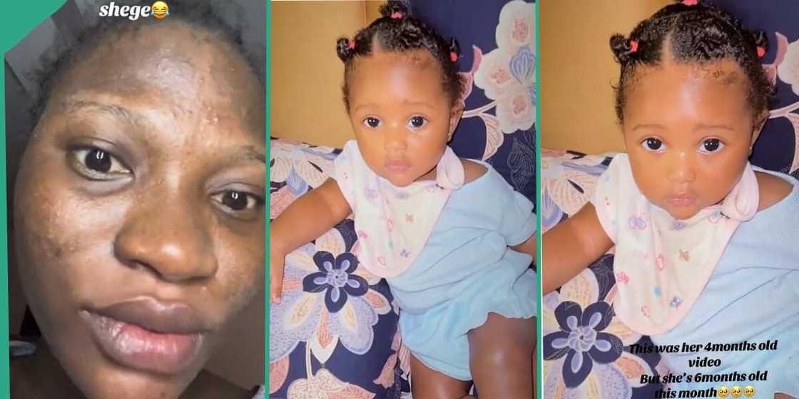 Lady who had damaged skin during pregnancy shows her baby. Lady who had damaged skin during pregnancy shows her baby.