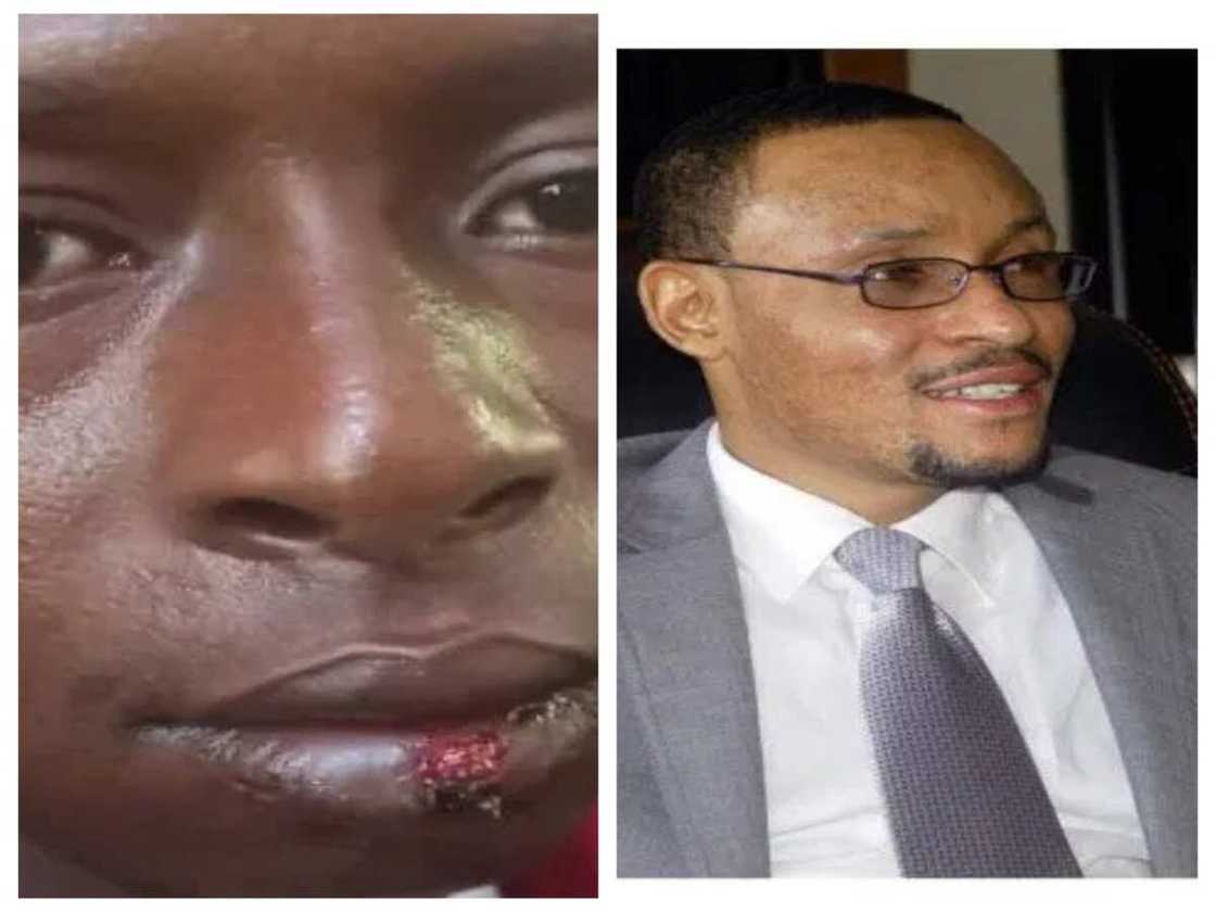 Ban yi wa Shugaban CCT komai ba, ya yi mani mugun duka, ya fasa mani baki inji Maigadi Ban yi wa Shugaban CCT komai ba, ya yi mani mugun duka, ya fasa mani baki inji Maigadi