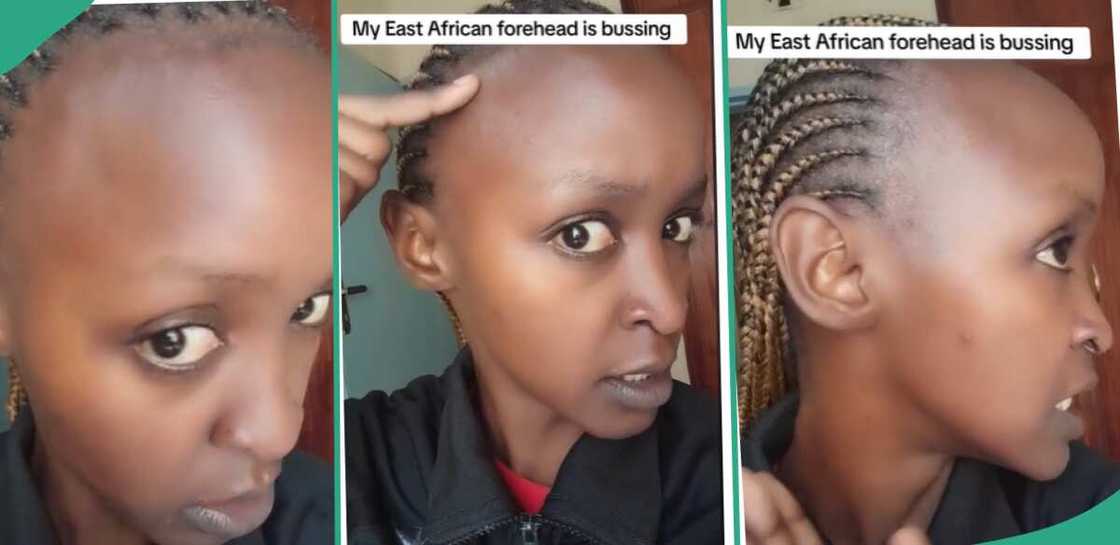 Lady shows off her unique hairline. Lady shows off her unique hairline.