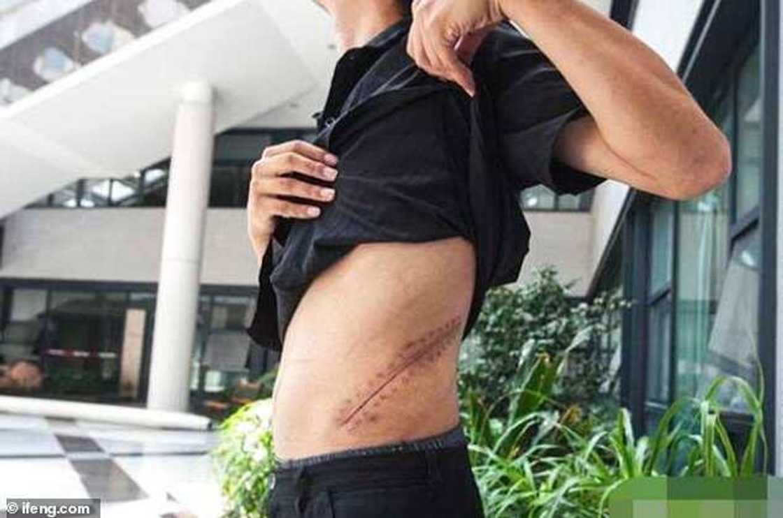 Yaron nan da ya sayar da kodarsa don sayen iPhone a 2011 na can yana bukatar koda Yaron nan da ya sayar da kodarsa don sayen iPhone a 2011 na can yana bukatar koda