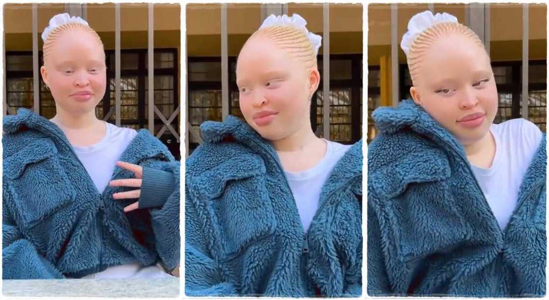 Photos of an albino lady who looks beautiful.