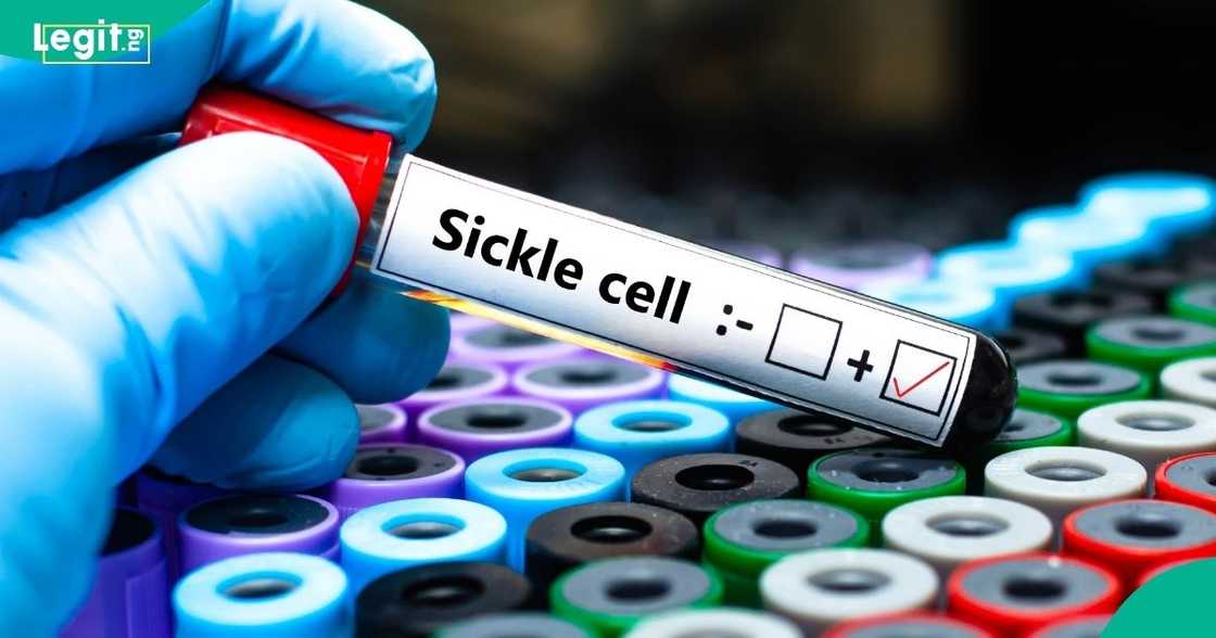 Ashcorp stands with the Sickle Cell Foundation of Nigeria Ashcorp stands with the Sickle Cell Foundation of Nigeria