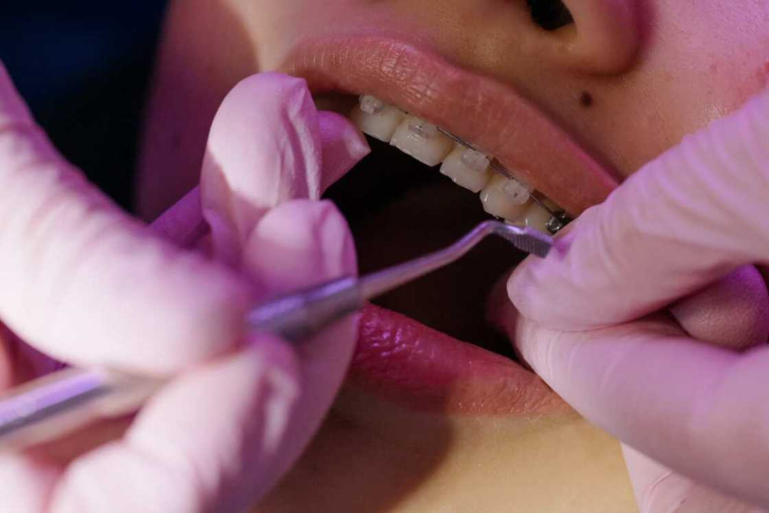 A dentist treating a tooth with braces A dentist treating a tooth with braces