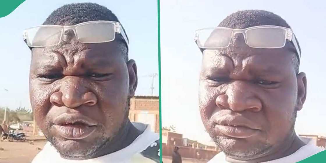 Man's unique nose makes him popular. Man's unique nose makes him popular.