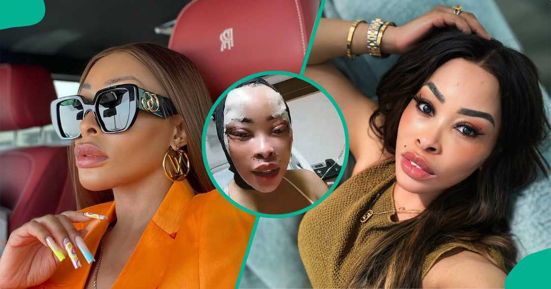 Khanyi Mabau is under fire over recent surgery. Khanyi Mabau is under fire over recent surgery.