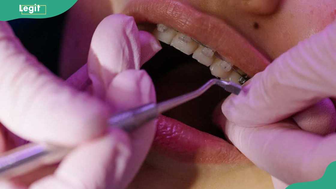 A dentist treating a tooth with braces