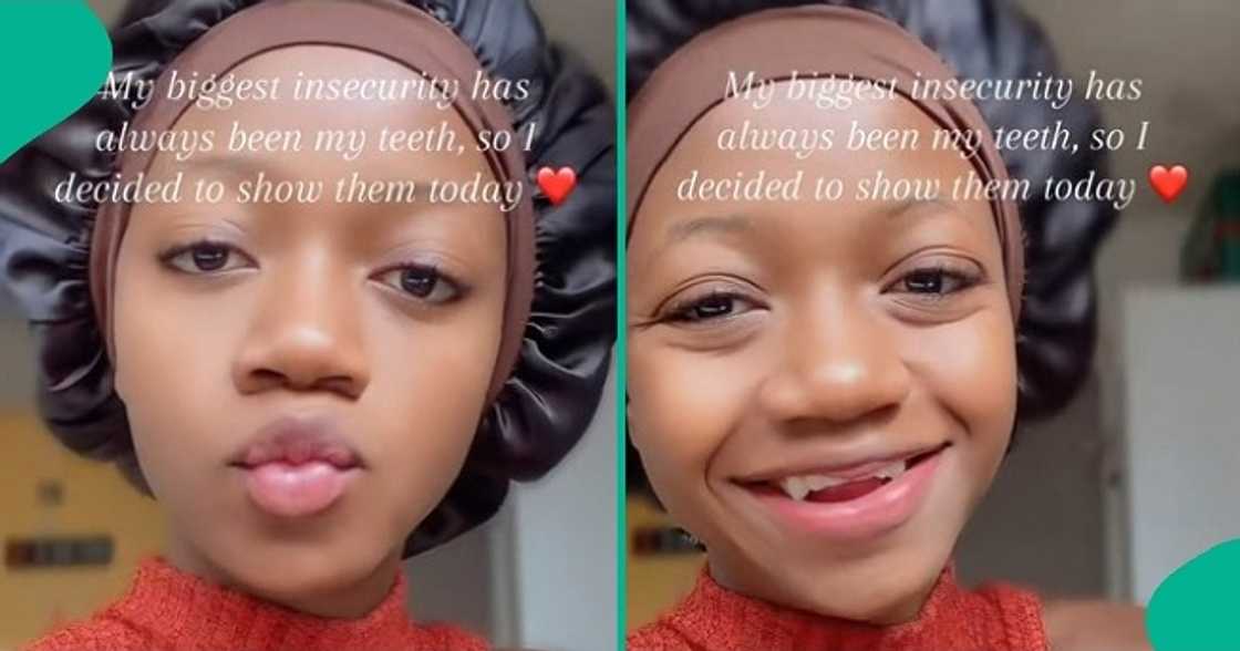 Lady gets confidence to show off her teeth, says they've always been her biggest insecurity. Lady gets confidence to show off her teeth, says they've always been her biggest insecurity.