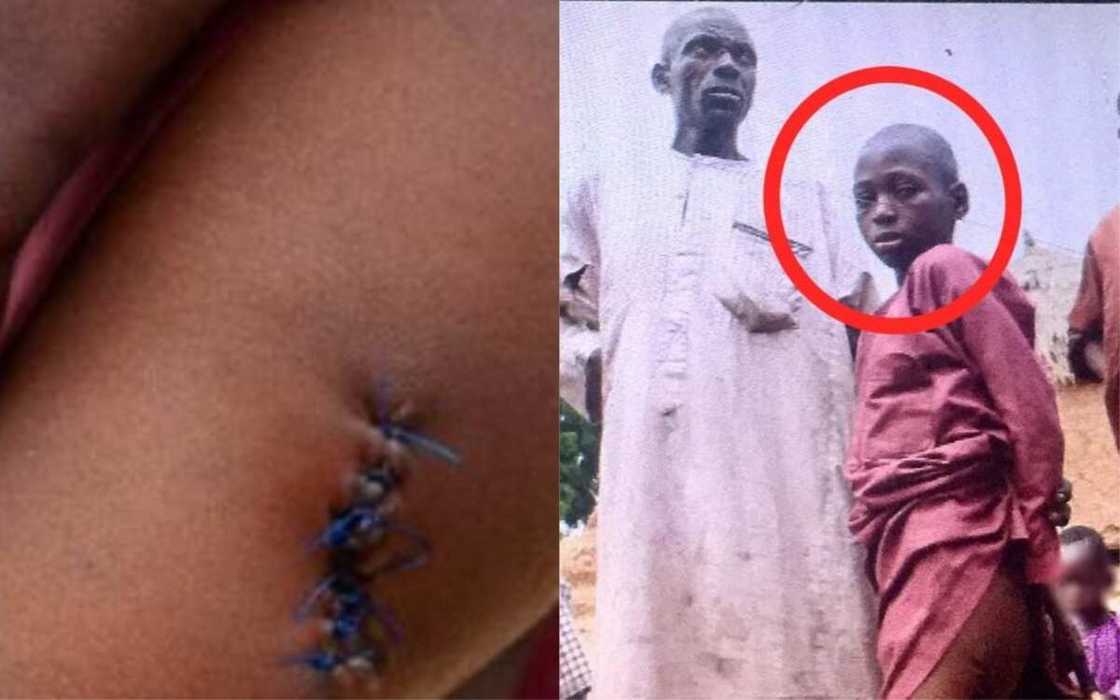 Zamfara: Dalibi mai shekaru 13 ya sanar da yadda ya kubuta daga miyagu duk da harbinsa da aka yi Zamfara: Dalibi mai shekaru 13 ya sanar da yadda ya kubuta daga miyagu duk da harbinsa da aka yi