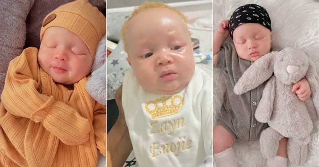 Mother shares video of her cute son with albinism