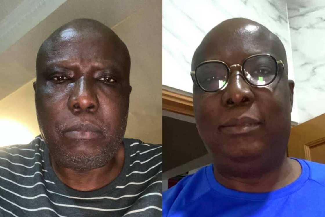 How COVID-19 almost killed me, Buhari’s aide reveals encounter with death How COVID-19 almost killed me, Buhari’s aide reveals encounter with death