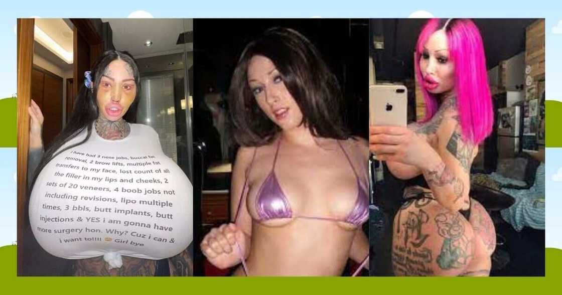 Suregery addict spends millions on body enhancement Suregery addict spends millions on body enhancement