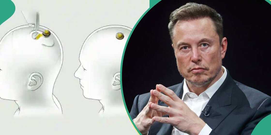 Elon Musk Neuralink