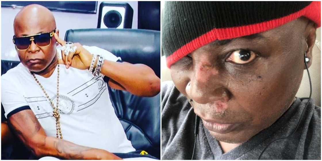 70-Year-Old Charly Boy Sustains Facial Injury After Falling off Scooter, Assures Fans He’s Healing Well