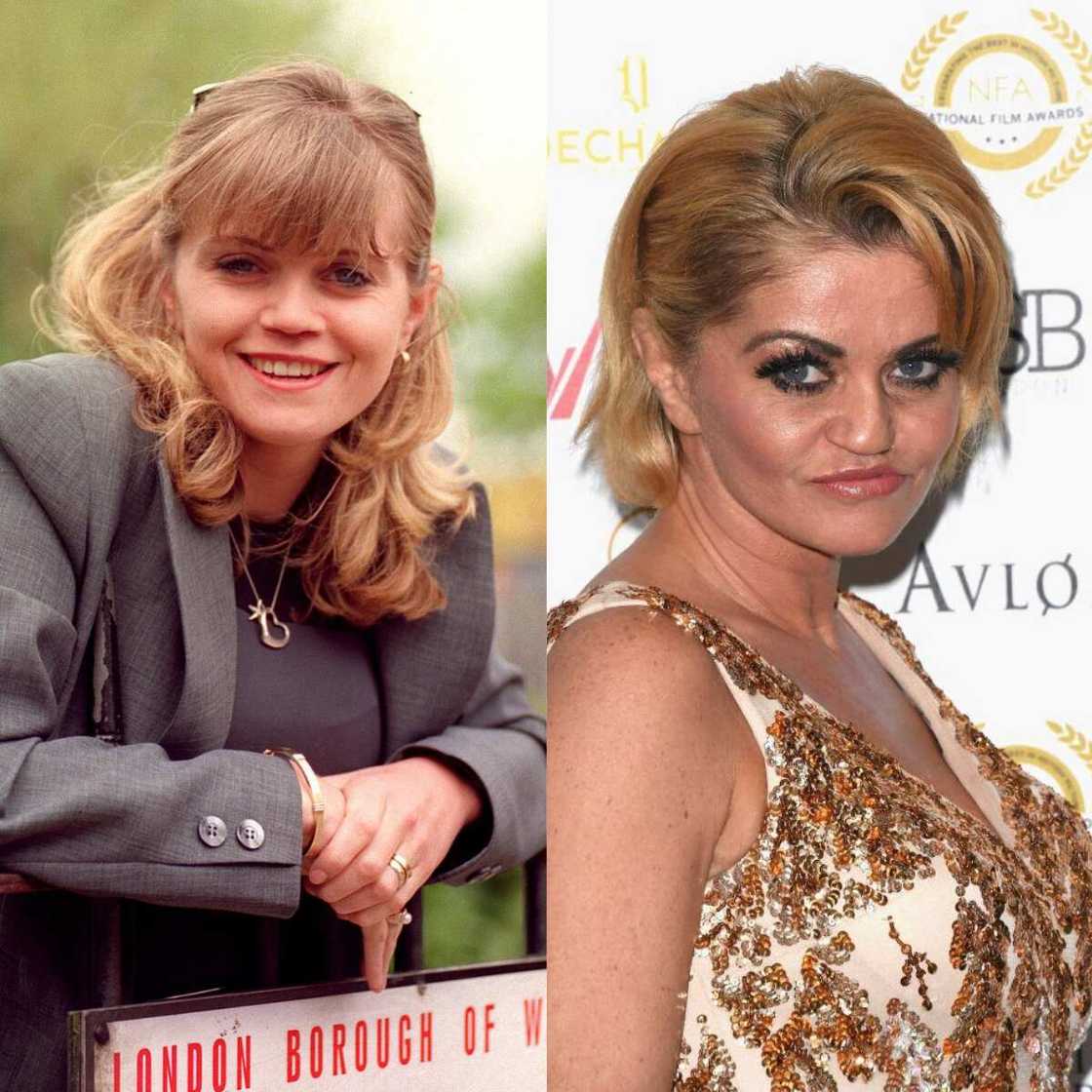 Danniella Westbrook before Danniella Westbrook before