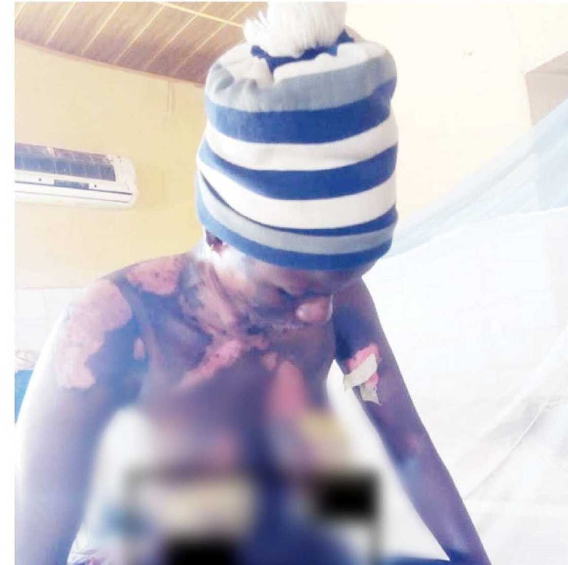 Ba zan taba yafe mata ba, Matar aure da kishiya ta babbaka da ruwan zafi Ba zan taba yafe mata ba, Matar aure da kishiya ta babbaka da ruwan zafi