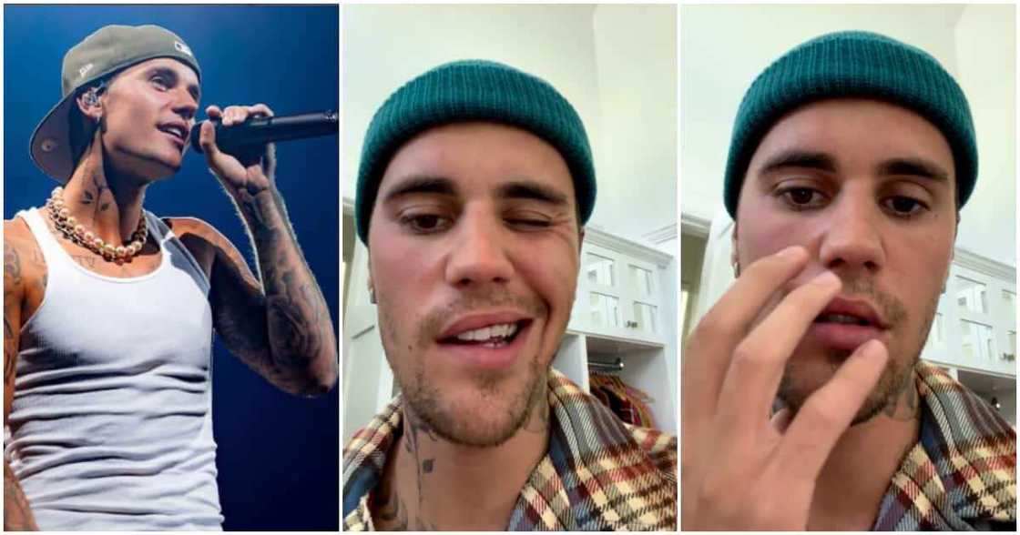 Justin Bieber Diagnosed With Ramsay Hunt Syndrome That Causes Partial Facial Paralysis, Hearing Loss Justin Bieber Diagnosed With Ramsay Hunt Syndrome That Causes Partial Facial Paralysis, Hearing Loss