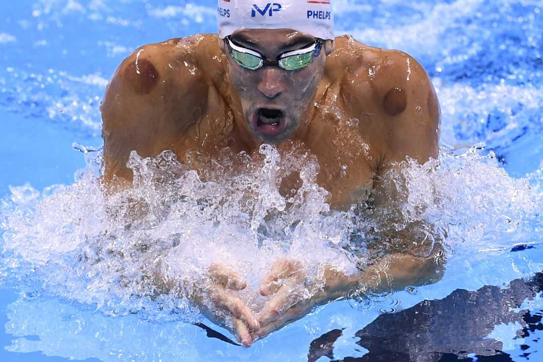 The telltale red marks of cupping seen on the shoulders of swimming great Michael Phelps in Rio The telltale red marks of cupping seen on the shoulders of swimming great Michael Phelps in Rio