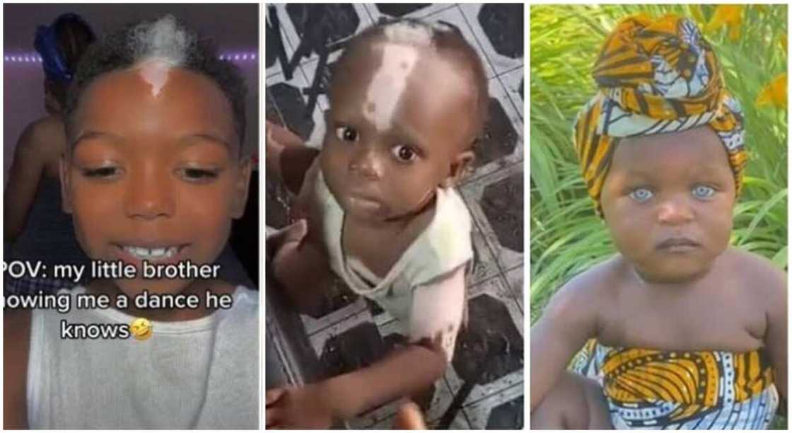 Photos of beautiful kids with unique body features. Photos of beautiful kids with unique body features.