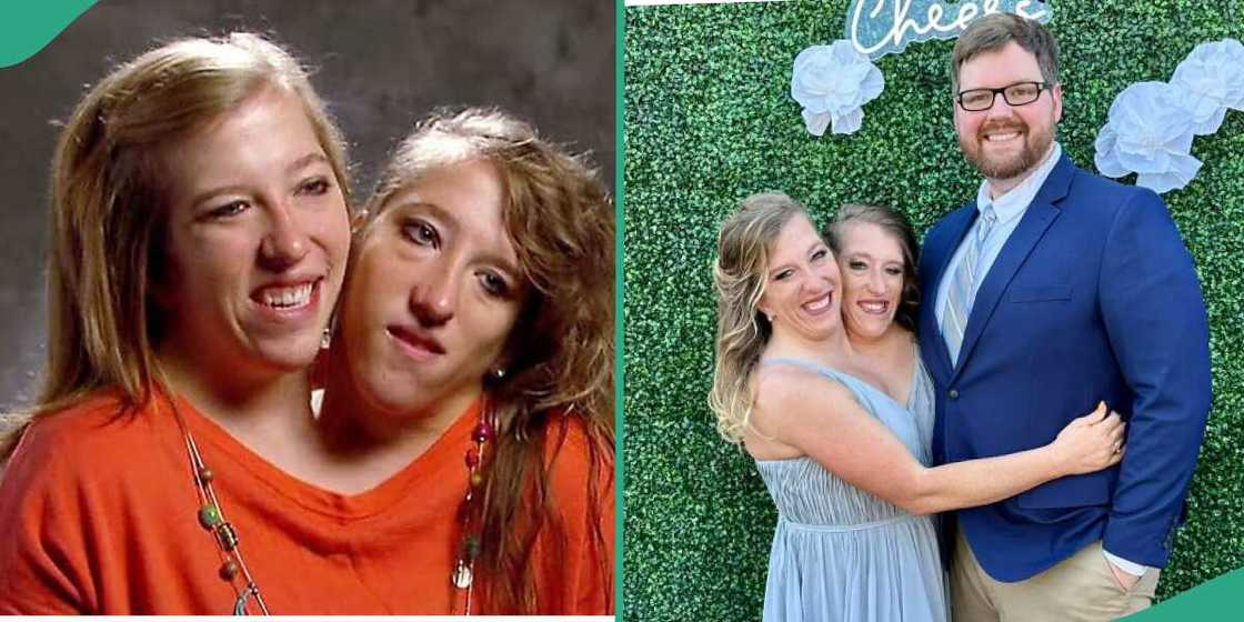 Conjoined twins Abby and Brittany Hensel. Conjoined twins Abby and Brittany Hensel.