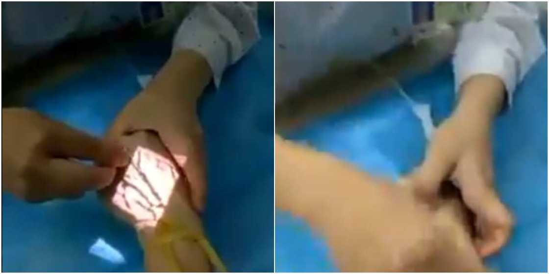 Reactions as Video Shows Oyinbo Doctor Using Vein Finder to Locate Veins Instead of Beating Patient's Hand Reactions as Video Shows Oyinbo Doctor Using Vein Finder to Locate Veins Instead of Beating Patient's Hand
