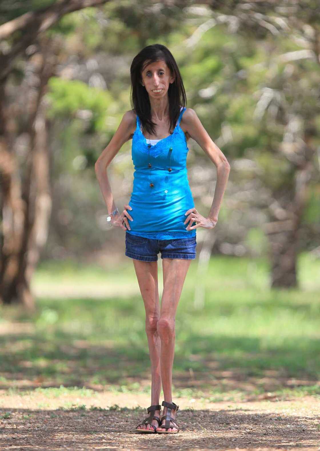 The skinniest lady The skinniest lady