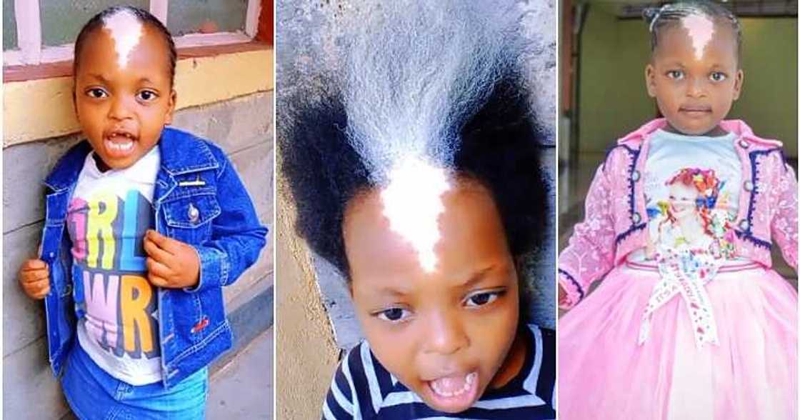 Little girl, unique birthmark, white frontal hairs Little girl, unique birthmark, white frontal hairs