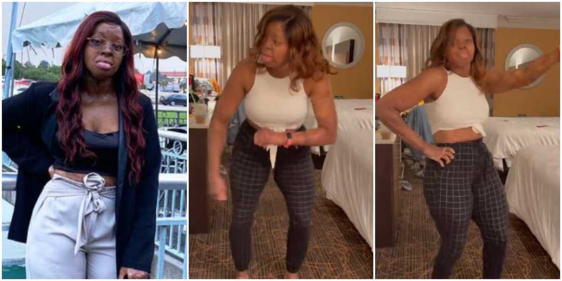 Nigerians gush over plane crash survivor Kechi as she joins 'dancina' challenge by Yemi Alade Nigerians gush over plane crash survivor Kechi as she joins 'dancina' challenge by Yemi Alade
