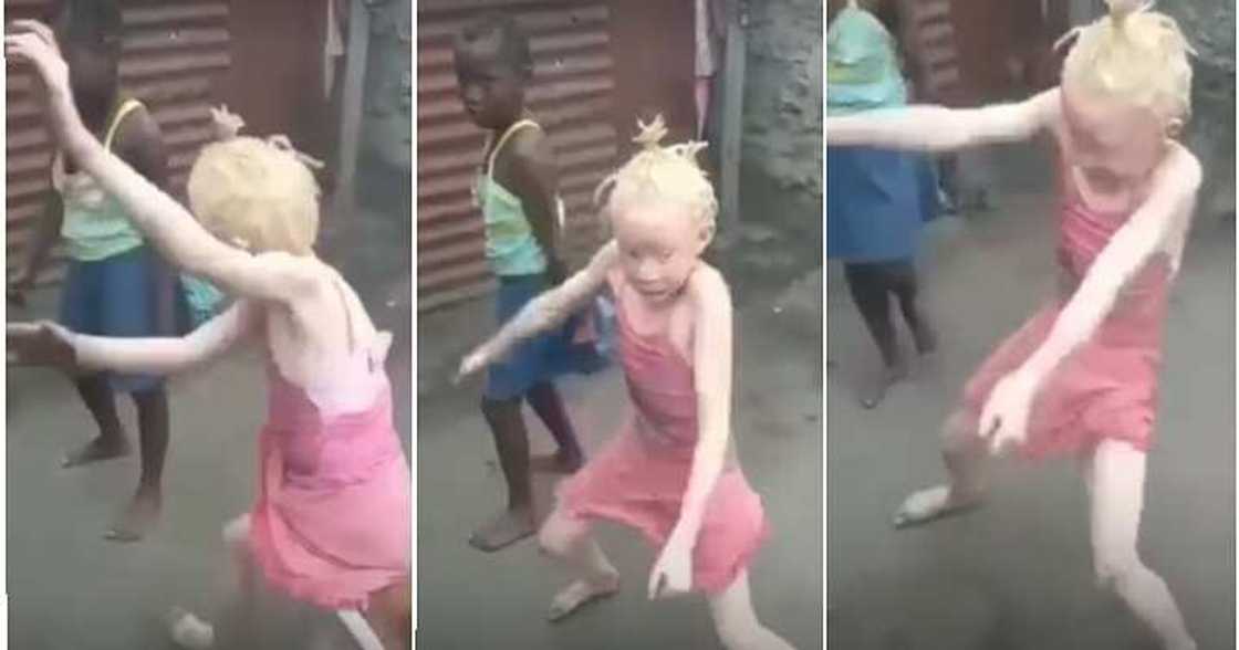 Albino dance, competition Albino dance, competition