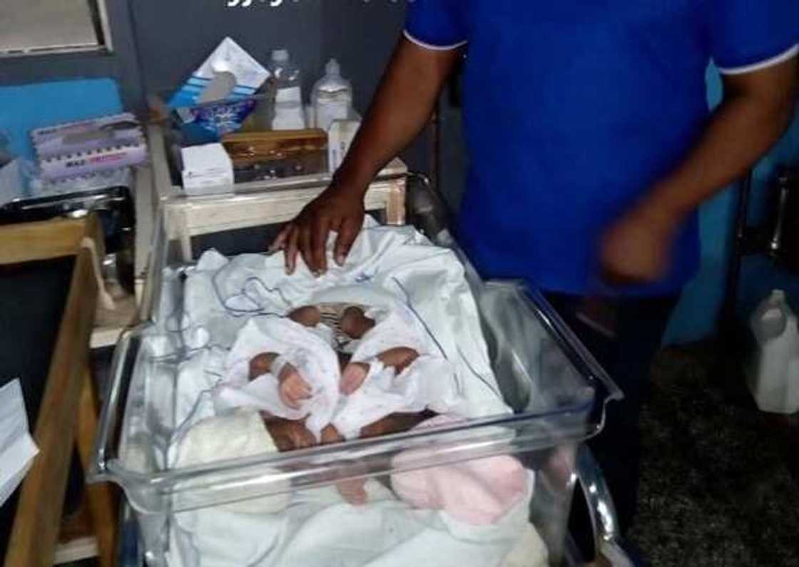 Ejura woman gives birth to Siamese twins Ejura woman gives birth to Siamese twins