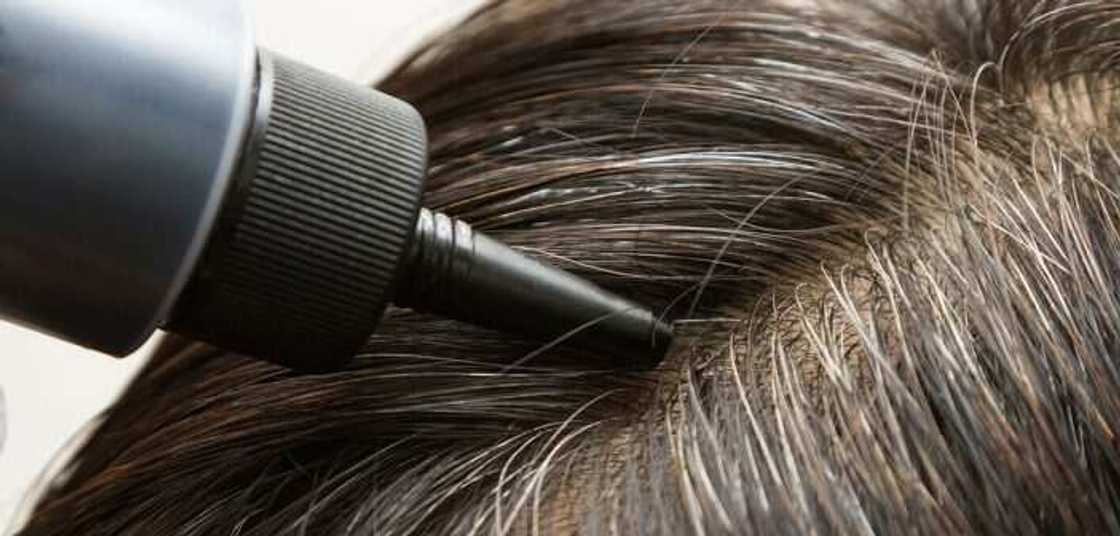 Hanyoyi 5 da mutum zai bi don hana furfura fitowa a jikinsa Hanyoyi 5 da mutum zai bi don hana furfura fitowa a jikinsa