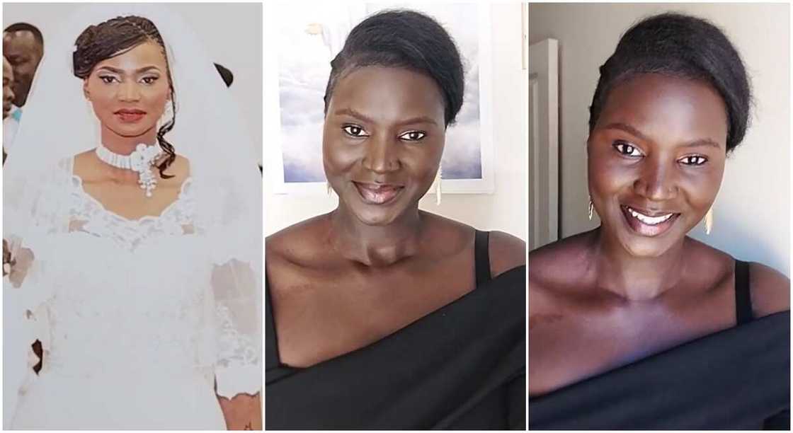 Photos of a lady who used to bleach her skin. Photos of a lady who used to bleach her skin.