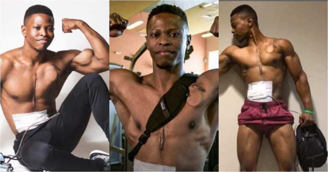 Meet Fitness Model who Walked with an Artificial Heart in His Backpack for Over 2 Years