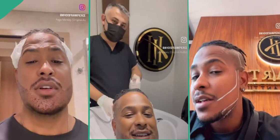 Beardless man, beards, beard transplant Beardless man, beards, beard transplant