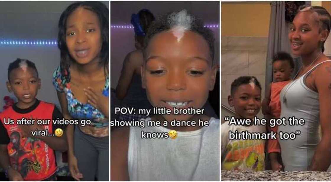 Lady with forehead birthmark, little boy with forhead birthmark Lady with forehead birthmark, little boy with forhead birthmark