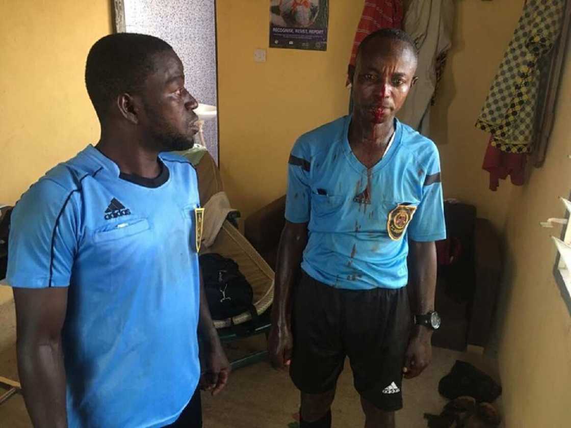 Hotunan Alƙalan Wasa Da Fusatattun Ƴan Kallo Suka Yi Wa Duka Ciki Har Da Wanda Ya Rasa Haƙoransa Hotunan Alƙalan Wasa Da Fusatattun Ƴan Kallo Suka Yi Wa Duka Ciki Har Da Wanda Ya Rasa Haƙoransa