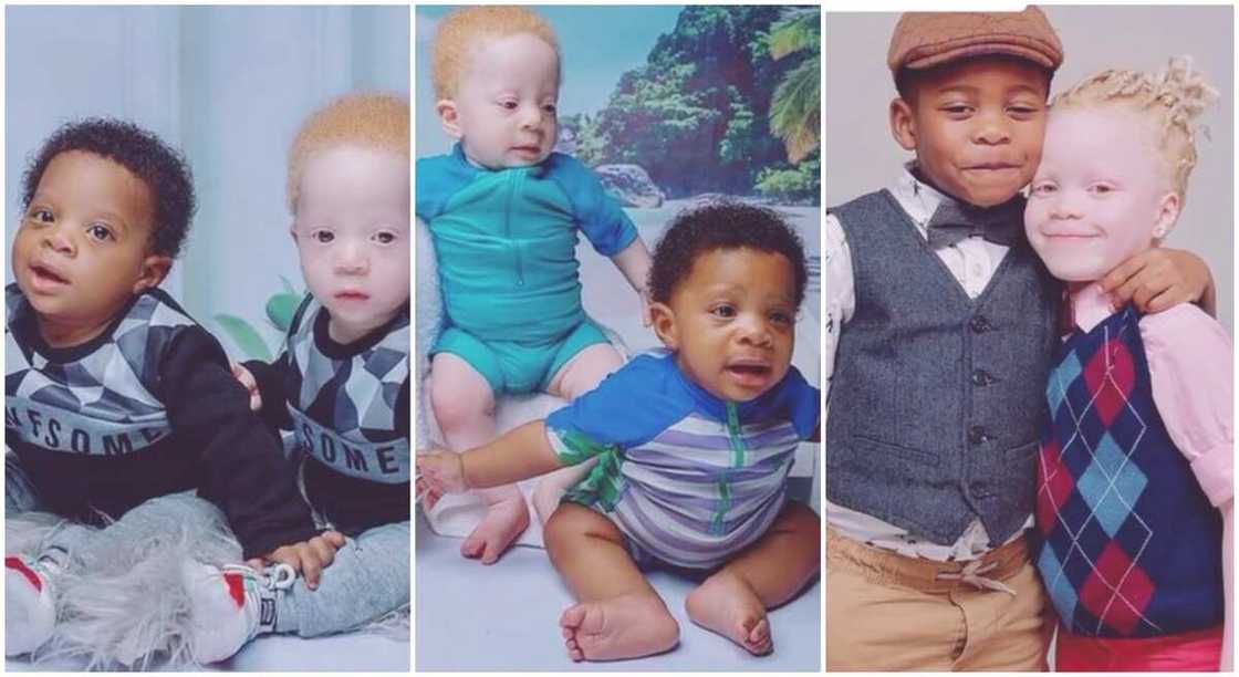 Photos of rare twins, one albino, one black. Photos of rare twins, one albino, one black.