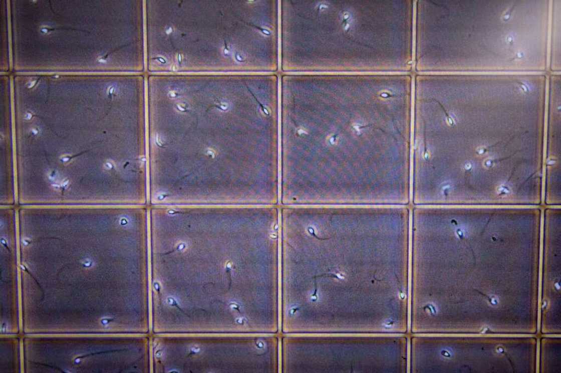 The new study includes data from more than 57,000 men collected over 223 studies across 53 countries, making it the largest meta-analysis ever conducted on the subject. The new study includes data from more than 57,000 men collected over 223 studies across 53 countries, making it the largest meta-analysis ever conducted on the subject.